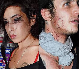 un talento autoduistruttivoamy-e-blake-briga